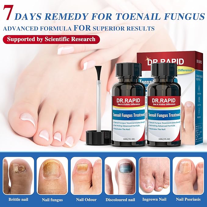 Toenail Fungus Treatment Extra Strength - Effective Antifungal Nail Repair Solution with Tea Tree Oil for Toenail & Nail Fungus, Fast Acting Treatment for Damaged Nails & Ingrown Toenail - 60ml/2fl oz
