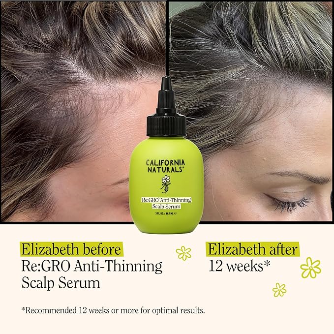 California Naturals Women's Re: Gro Anti-Thinning Scalp Serum, 5% Capixyl with Biotin, Caffeine & Castor and Rosemary Oil, Non-Sticky Cooling Formula, Vegan & Cruelty Free, 3oz