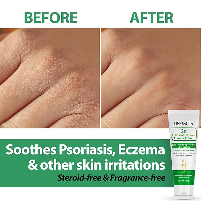 2% Colloidal Oatmeal Eczema Lotion - Soothing and Moisturizing Anti-Itch Cream & Body Lotion with Aloe Vera, Shea and Glycerin - Nourishing Eczema Cream for Superior Relief and Protection 8oz