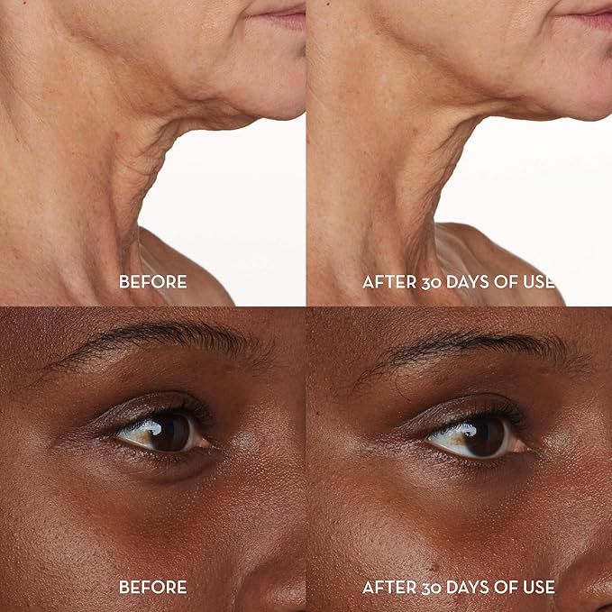 Furtuna Skin Face & Eye Serum - Dual-Use Formula to Lift, Reduce Puffiness and Even Tone, Wild-Foraged Botanicals, Vegan, Dermatologist Tested, EWG Verified, 30ml