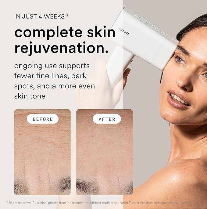 Nood™ NEW Flasher Pro — IPL Laser Hair Removal Device & Anti-Aging Red Light Therapy for Women & Men — Pain-free, Permanent, Visible Results After First Use & Works Everywhere Hair Grows — Matte Black