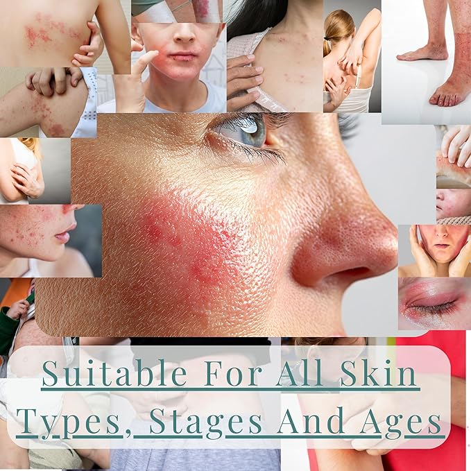 JusSpray™ Hypochlorous Acid (HOCl) Spray – Doctor Approved Skin Defense Mist 4 oz – Face & Body Toner for Sensitive, Acne & Eczema-Prone Skin, Redness Relief & Piercing Aftercare (3-Pack)