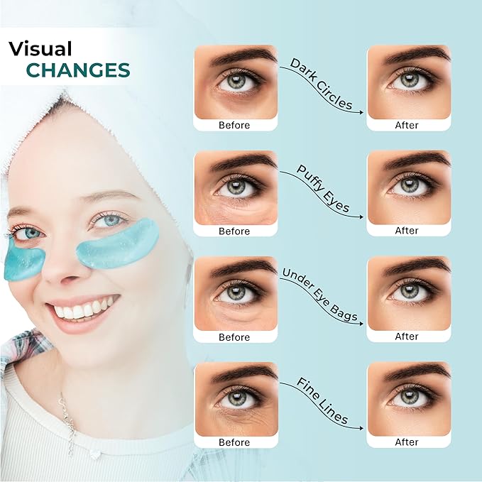 Herbs Healthy Healing 24K Gold Under Eye Masks – Collagen & Hyaluronic Acid Gel Patches for Dark Circles, Puffiness, Fine Lines – Eye Masks for Women & Men – 20 Pairs, Clean Beauty Skincare