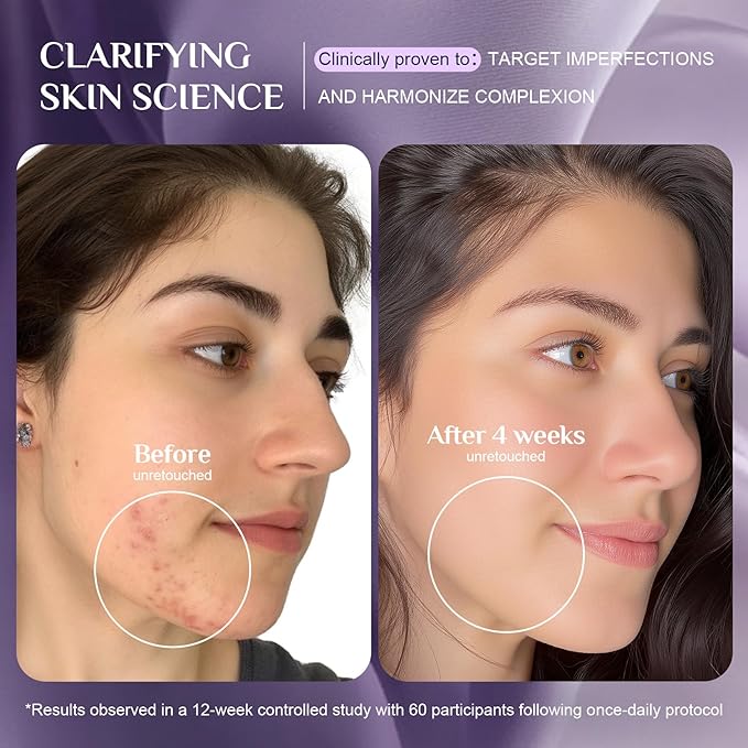 LED Light Therapy Mask Skin Care Mask, Glow Wireless LED Red LED Red 630±5nm & NIR 830nm Wavelength for Home Use