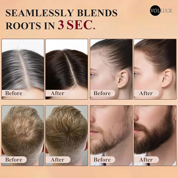 VOLLUCK Hairline Powder Instantly, Root Touch up Powder Hair Color Upgraded, Grey Root Cover up Conceals Hair Loss, Hairline Shadow for Women & Men for Thinning Hair Natural, Sweatproof (Dark Brown)