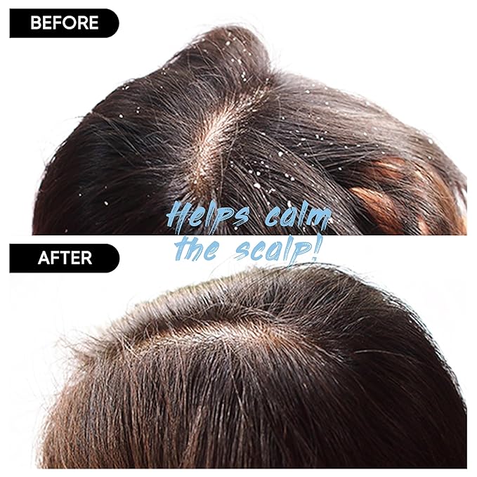 Red Bean Shampoo Bar 2.0 - Hydrating & Moisturizing Natural Hair Soap for Hair Color & Scalp Nourishment - Solid Shampoo for All Hair Types (120g, 4.23oz)