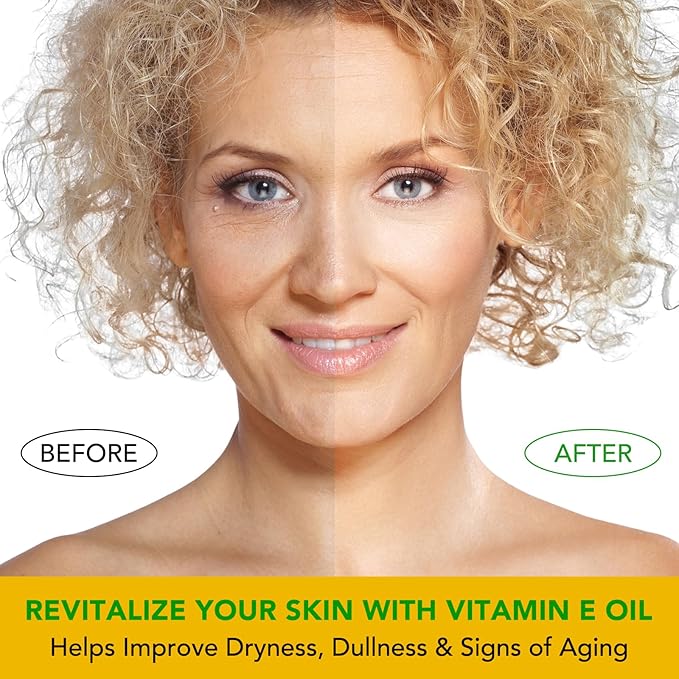 ELBBUB Vitamin E Oil - 75,000 IU Ultra Concentrated - Moisturizes, Fades Scars & Stretch Marks, Anti-Aging & Skin Hydration - for Face, Body, Hair, and Nails