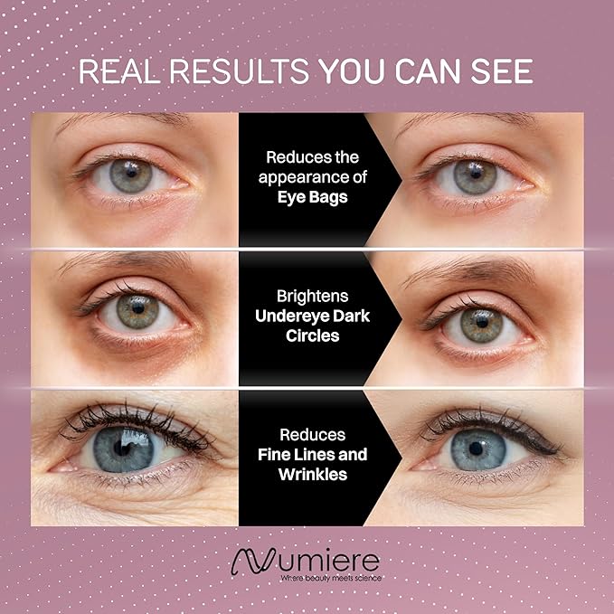 Lumina NRG Under-Eye LED Light Therapy Device for Dark Circles, Puffiness, Wrinkles & Fine Lines, Revitalize Skin, Massager for Eyelift & Skincare, Revive Kit For Eye Bags – Unisex, 1 Size