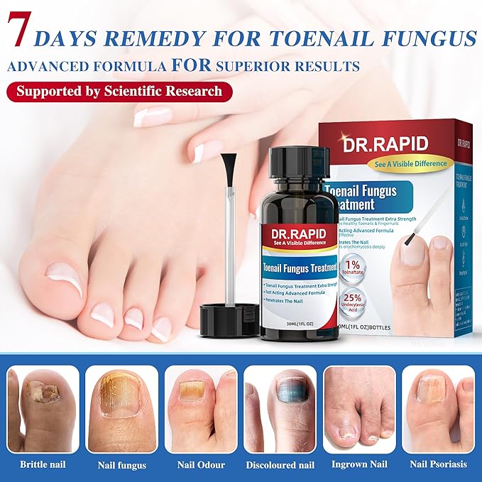 Toenail Fungus Treatment Extra Strength - Effective Antifungal Nail Repair Solution with Tea Tree Oil for Toenail & Nail Fungus, Fast Acting Treatment for Damaged Nails & Ingrown Toenail - 30ml/1fl oz
