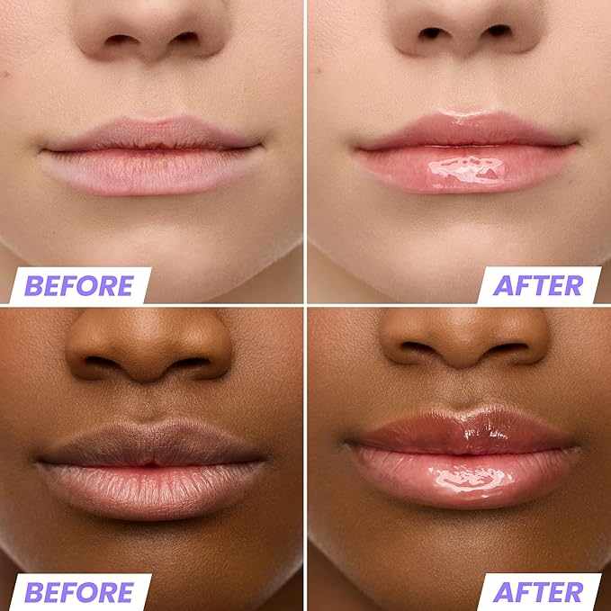 Wonderskin Lip Oil Rehab Serum - Tinted Lip Oil, Hydrating, Moisturizing, and Non-Sticky Coral Pink Tint Serum for Dry Lips (Lover)