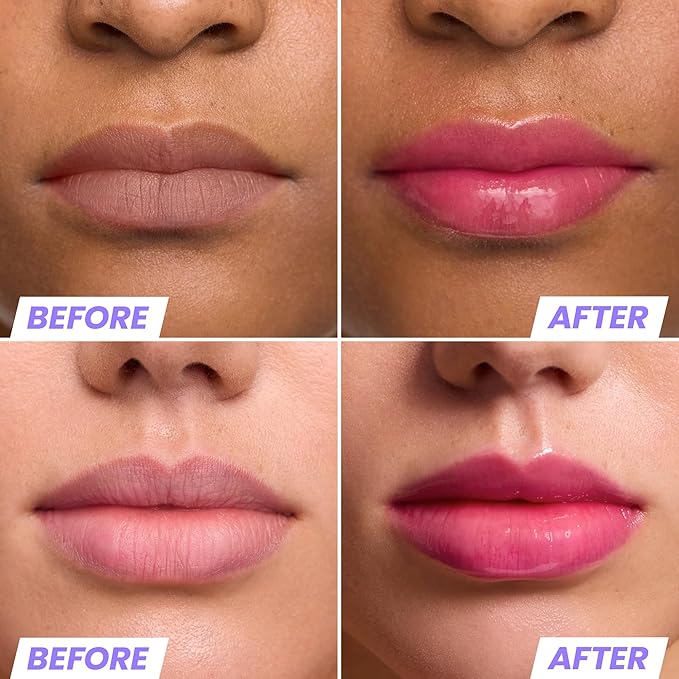 Wonderskin Lip Rehab Serum Oil (Kissed (2 Pack))