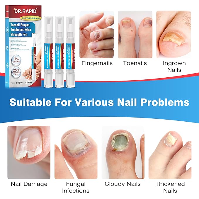 Toenail Fungi Treatment Extra Strength - Fungi Nail Pen Antifungal Repair for Damaged Nails, Fast-Acting Solution for Toe & Fingernail Fungi, Ideal for Nail Health Concerns Athletes 5ml/0.18FLOZ 3Pcs
