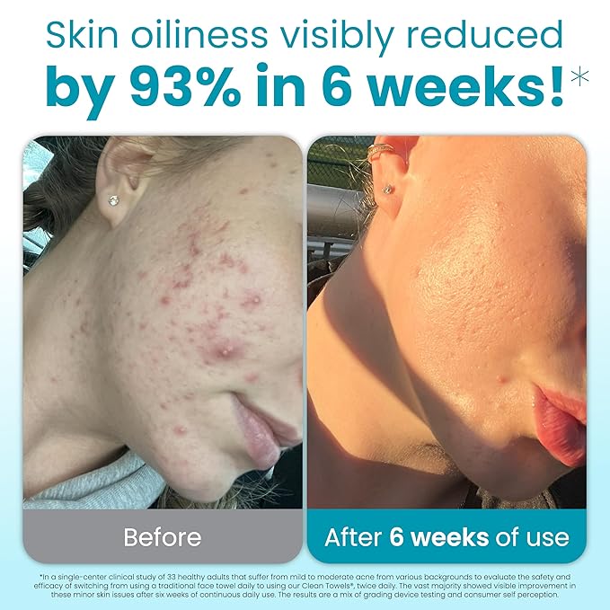 Clean Skin Club Blemish Control Clean Towels® XL, Compostable Face Towels, Light Exfoliation for Oily Skin, Eczema Association Accepted Disposable Face Towelette, Makeup Remover Dry Wipes, 50 count