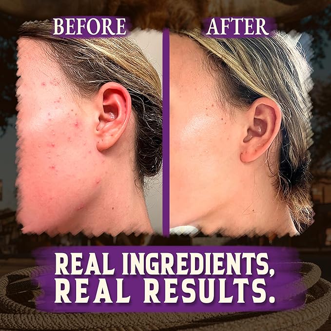 Organic Beef Tallow for Skin - 2OZ (Lavender, Concentrated) — Grass Fed Beef Tallow for face + Body — US-Made Tallow and Honey Balm Moisturizer for Dry & Sensitive Skin, Eczema, Rosacea(No Additives)