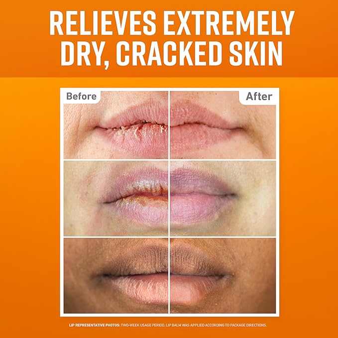 O'Keeffe's Lip Repair Lip Balm Set for Dry, Cracked Lips - Stick (Pack of 3: 1 Cooling + 1 Unscented + 1 SPF) - Moisturizer for for Extremely Cracked, Dry Lips