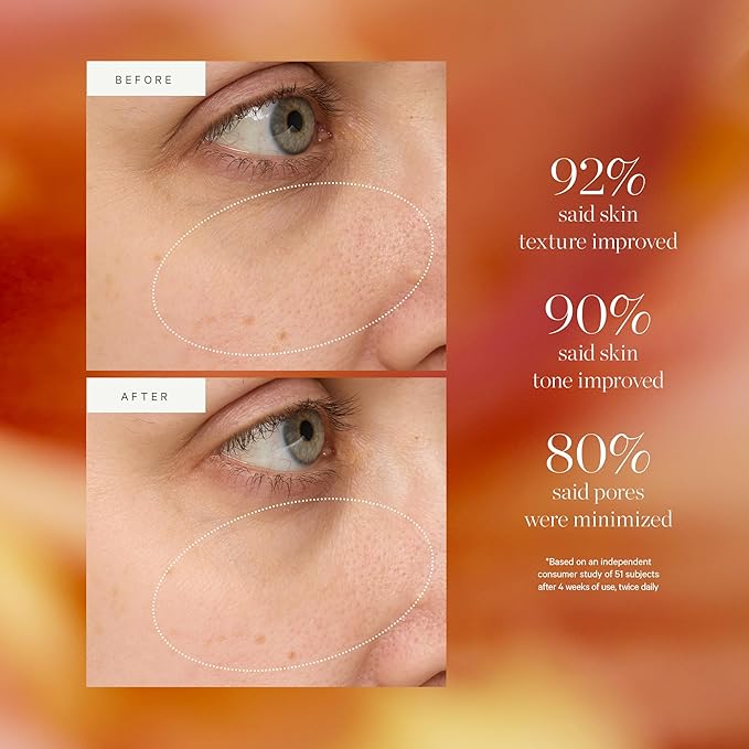 KORA Organics Turmeric Glow Drops, Certified Organic Radiance Face Serum with Niacinamide Alternative, Improves Texture & Pore Appearance, Vegan, 0.34 fl oz