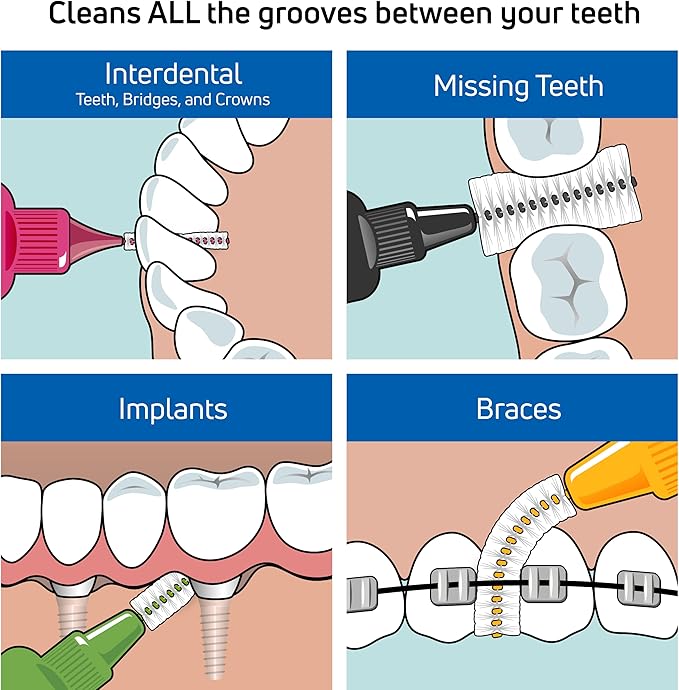 TePe Pack of 25 Interdental Brush Original, Soft Dental Brush for Teeth Cleaning, 4, Yellow