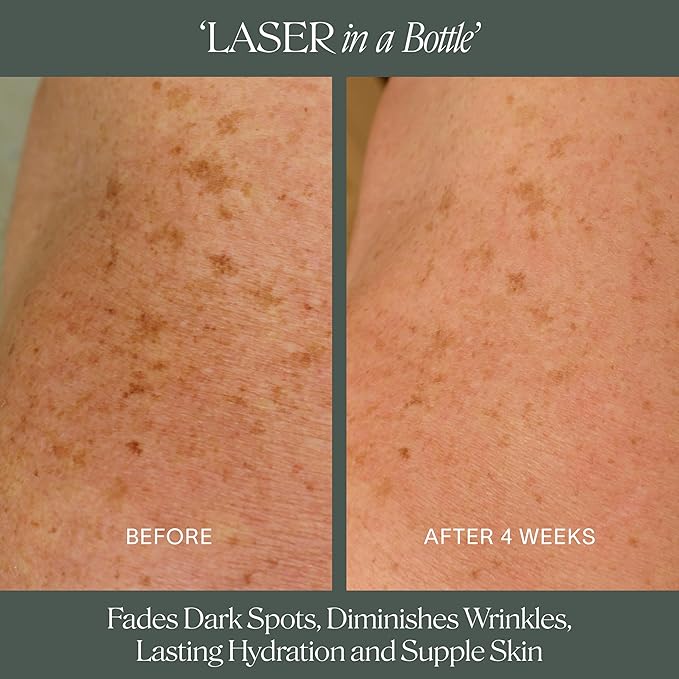 Doctor Rogers Body Repair Treatment Serum, 5 Ounce (150 ml)