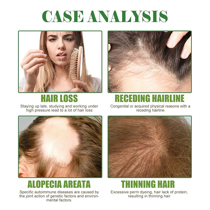 100% Pure Organic Rosemary Essential Oil for Hair Growth - Multi-Purpose Hair Treatment Oil Promotes Eyelash & Eyebrow Growth, 2.02fl oz (Small, Rosemary)