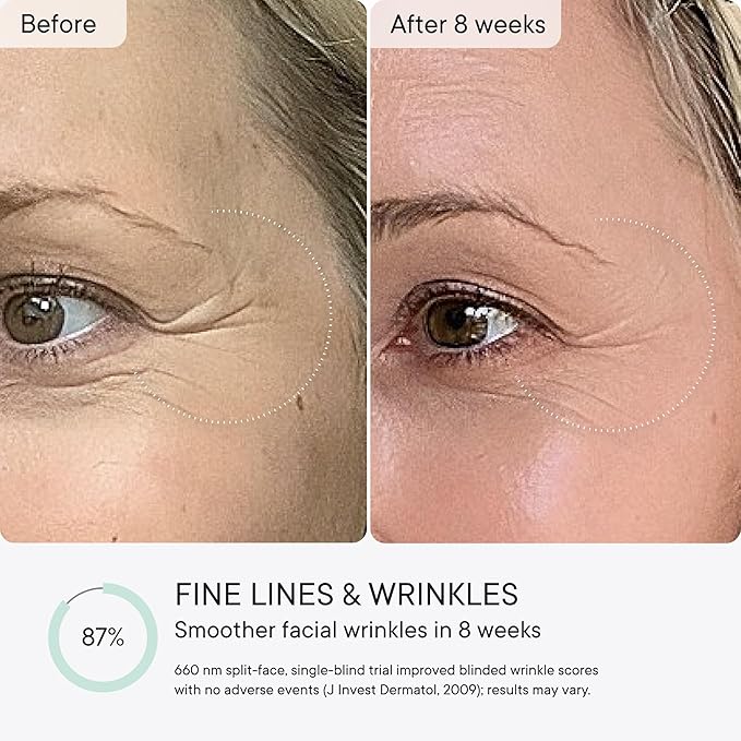 Qure Red Light Therapy for Face – LED Mask with 5 Light Modes for Anti-Aging, Acne, Wrinkles & Dark Spots, 3-Min Wireless Daily Treatments, Smart App Control with Reminders, FDA Cleared