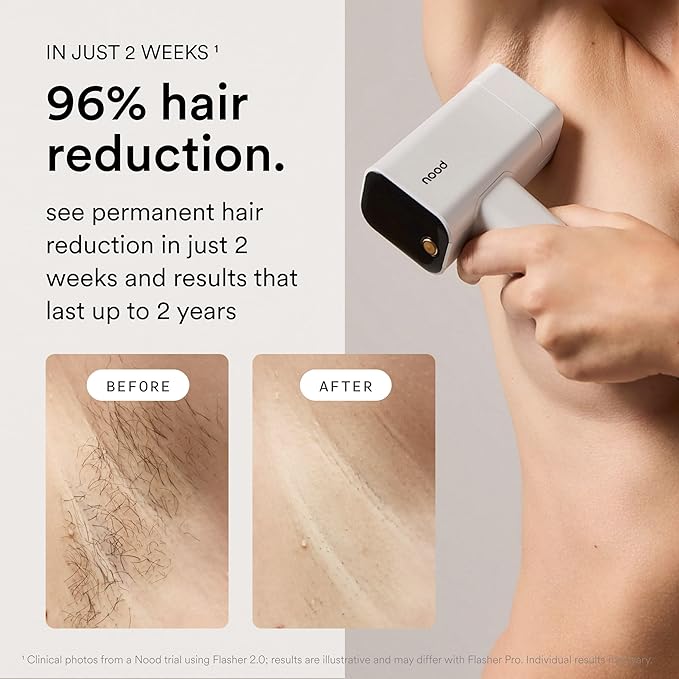 Nood™ NEW Flasher Pro — IPL Laser Hair Removal Device & Anti-Aging Red Light Therapy for Women & Men — Pain-free, Permanent, Visible Results After First Use & Works Everywhere Hair Grows — Gloss White