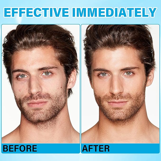 Beef Tallow Balm for Skin & Face, Men's Multi-Function Tallow Face Moisturizer, 100% Grass-Fed Beef Tallow, Ultra-Hydrating Body Cream for Dry/Sensitive Skin, 1.76 Oz