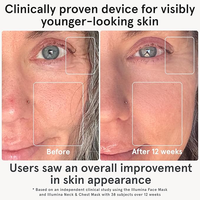 iRestore LED Face Mask for Youthful Skin, Anti-Aging Red Light Therapy for Face, Red, Blue & Infrared Therapy for Wrinkles, Fine Lines, Dark Spots with 360 LEDs - Skincare Device for Women & Men