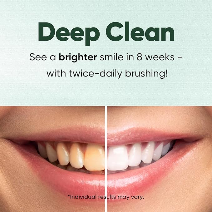 MySmile Fluoride Free Toothpaste, Nano Hydroxyapatite for Sensitive Teeth, Strengthens Enamel, Supports Remineralization & Bright Teeth, Freshens Breath for Adults, SLS Free, Natural Misty Mint, 4.2oz