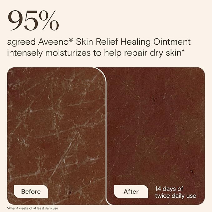 Aveeno Skin Relief Healing Ointment, Repair & Protect Extra Dry, Cracked Skin, Glycerin Protectant with Triple Oat & Shea Butter, Fragrance-Free & Non-Greasy Feel, Travel Size, 2.0 oz
