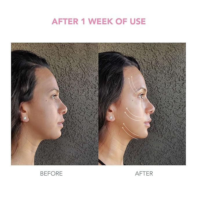 FOREO Firm & Fabulous BEAR mini + Serum Serum Serum 1 Oz Anti aging Starter Kit- Microcurrent Facial Device- Instant Face Lift- Double Chin Eliminator- Facial Skin Care Products- Gift Set- Pearl Pink