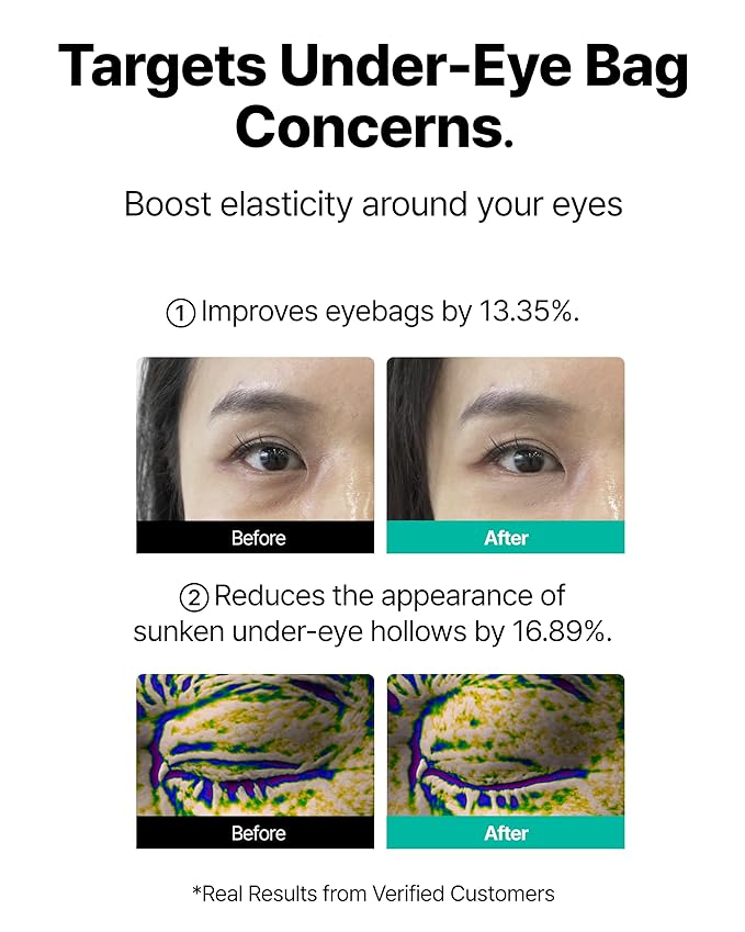 CHARDE Eye Bag Lift 1100 Shot Reedle Patch | Advanced Under-Eye Care with Lift Tox 50.2%, Cica Exosome, Niacinamide for Dark Circles & Puffiness | Korean Skin Care | 8 Patches (4 pairs)