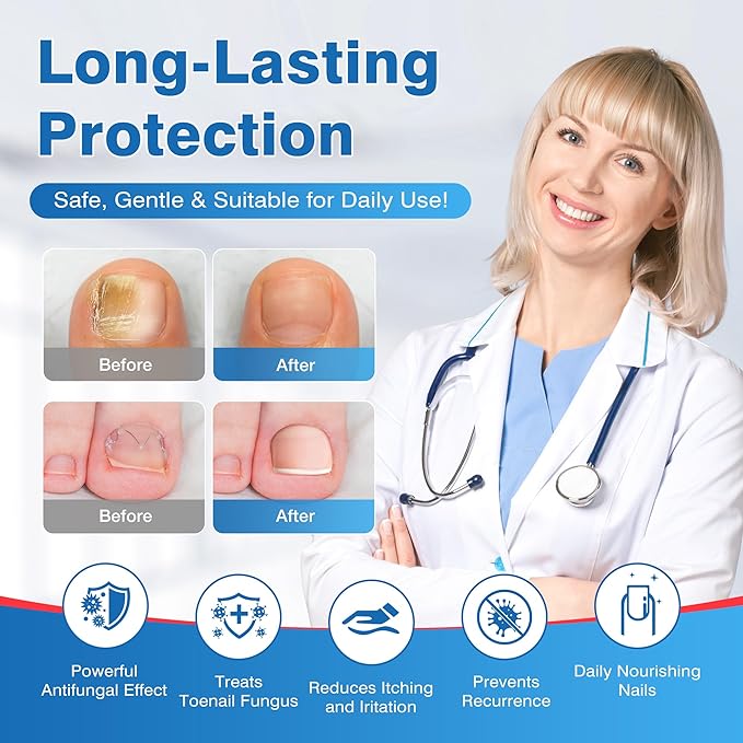 Toenail Fungi Treatment Extra Strength - Fungi Nail Pen Antifungal Repair for Damaged Nails, Fast-Acting Solution for Toe & Fingernail Fungi, Ideal for Nail Health Concerns Athletes 5ml/0.18FLOZ 3Pcs