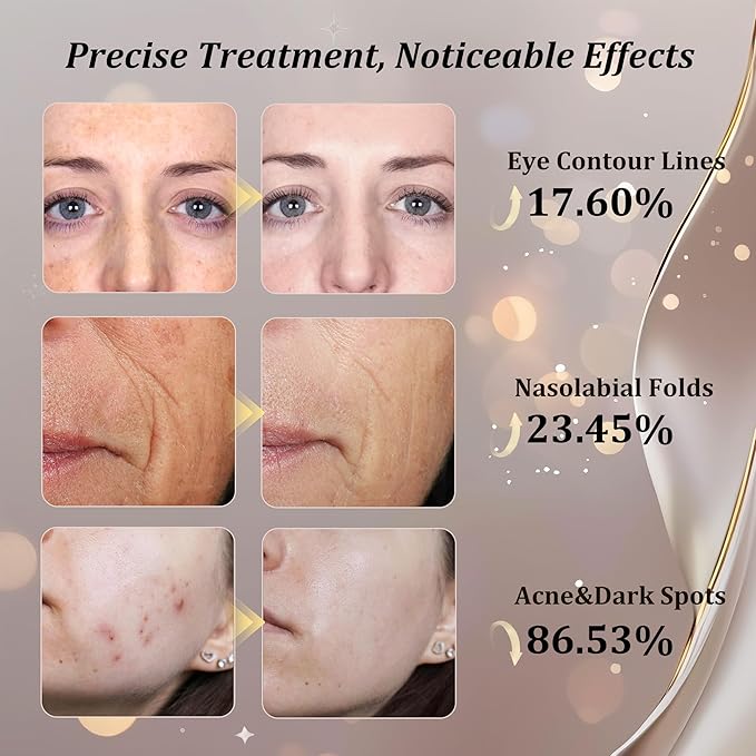 CUEME LED Light Therapy Mask, FDA-Cleared Red Light Therapy for Wrinkles, Acne Treatment, and Skin Care, Portable Facial Mask for Women - Mom, Sister, Girlfriend and Wife