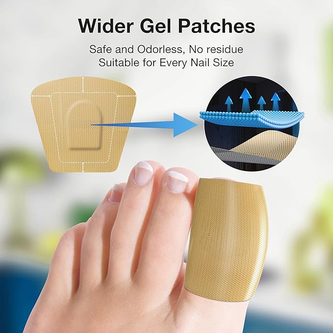 Toenail Fungus Treatment Extra Strength – 30mL Liquid Solution and 20 Fungal Nail Patches for Thick, Brittle or Discolored Nails – Gentle Repair for Damaged Toenails and Fingers–Dual-Action Treatment