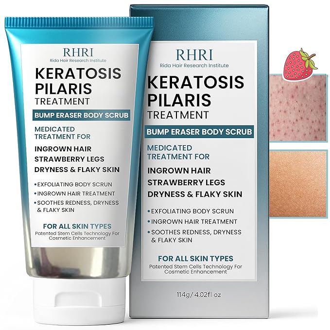 KP Bump Eraser Body Scrub | Keratosis Pilaris Treatment | Bump Eraser Body Scrub | Exfoliating Body Scrun | Ingrown Hair Treatment | Clears Strawberry Legs | Soothes Redness, Dryness & Flaky Skin