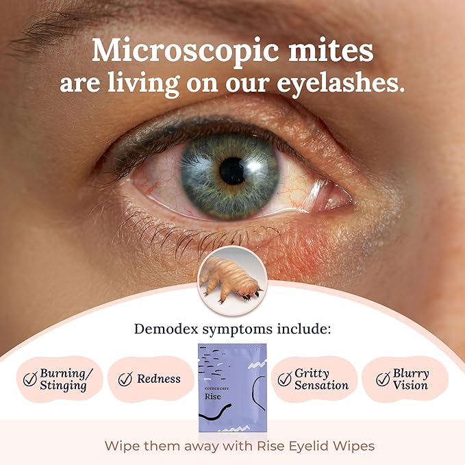 CorneaCare Rise: Eyelid Wipes | Eye Wipes for Dry Eyes | Eyelid Wipe with Tea Tree Oil & Hyaluronic Acid | Travel Ready | 30 Count