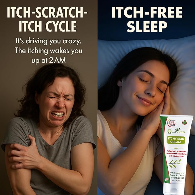 Oleavicin Extra Strength Anti-Itch Cream (2 Pack) for Dry, Itchy Skin Relief – Natural Fungal & Rash Treatment with Olive Leaf Extract – Fast-Acting, Long-Lasting Itch Relief