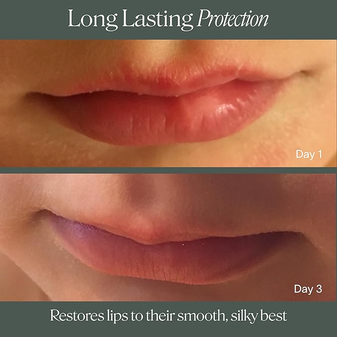 Doctor Rogers Lip Balm. Hydrating & Softening Lip Moisturizer for Very Dry Lips, Natural & Hypoallergenic, 0.15 Ounce (4.25 g), Pack of 3 tubes