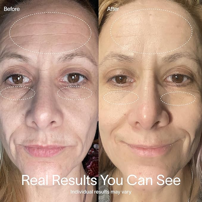 Solawave Red Light Therapy Mask for Face | Red & Near-Infrared Led Light Device | Reduces Appearance of Fine Lines & Wrinkles | Improves Firmness, Elasticity, & Texture | 10-Min Anti-Aging Treatment