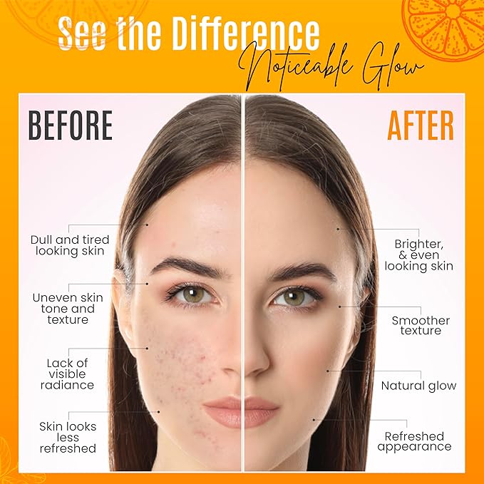 30% Organic Vitamin C Serum for Face – Natural Anti-Wrinkle Serum with Hyaluronic Acid & Vitamin E – Anti-Aging Moisturizer for Fine Lines, Dark Spots & Skin Rejuvenation – 2 Fl oz