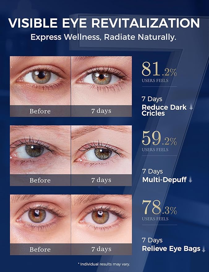 Retinol Eye Cream for Dark Circles with Caffeine Peptides Niacinamide Tranexamic Acid | Under Eye Cream for Puffiness and Eye Bags | Hydrating Firming Korean Eye Care - 1.06 oz