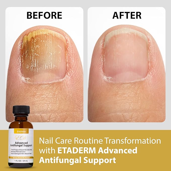 Nail Care & Repair Formula - Advanced Nail Repair for Damaged Nails Supported by Growth Oil and Enriching Serum - Promotes Polished Finish, Smooth Texture and Strengthened Nails Appearance
