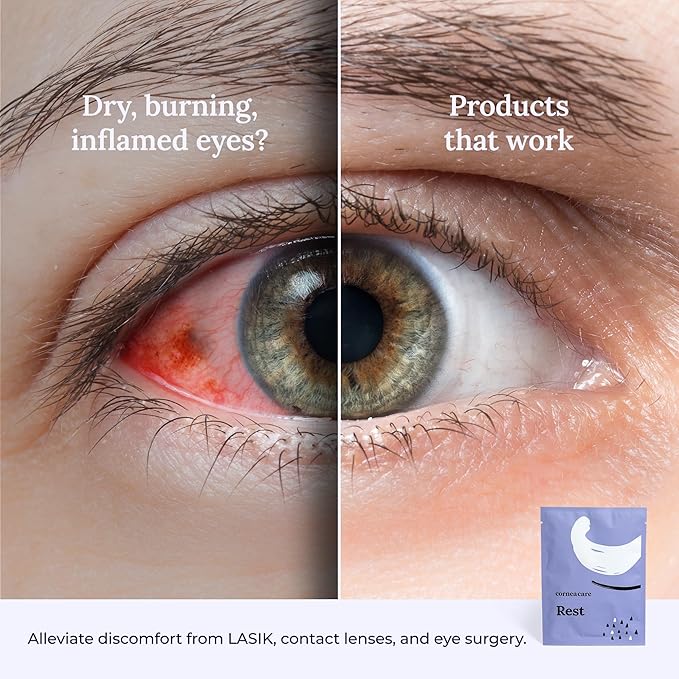 CorneaCare Rest: Self heating warm compress for dry eye | Heated eye Mask for fast relief | No microwave or washcloths needed | Travel ready | 90 counts