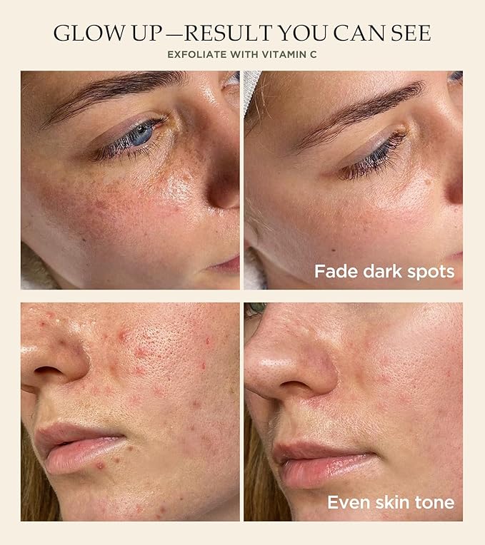 Vitamin C and Turmeric Face Scrub, Face Scrub for All Skin Types -Physical Scrub to Exfoliate Face & Body, Anti Aging Facial Exfoliating Scrub, Clears Blackheads Improve Dark Spots 4.23 Oz