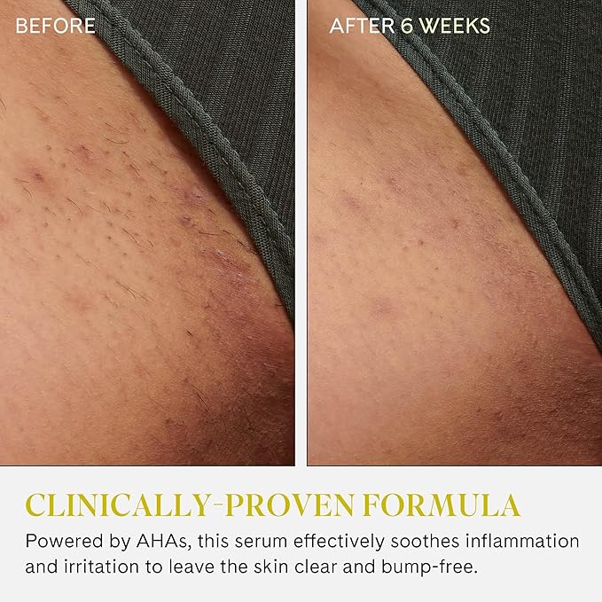 Fur Ingrown Eliminator Serum Rollerball Travel Size - Powerful Ingrown Hair Treatment Serum With AHAs and BHAs to Treat Ingrown Hairs and Bumps, Hydrates and Soothes Irritated Skin - 10 ml