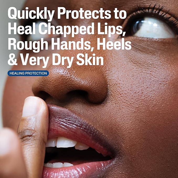 CETAPHIL Healing Ointment, 3 oz, For Dry, Chapped, Irritated Skin, Heals and Protects, Soothes Cracked Hands and Chapped Lips, Hypoallergenic, Fragrance Free