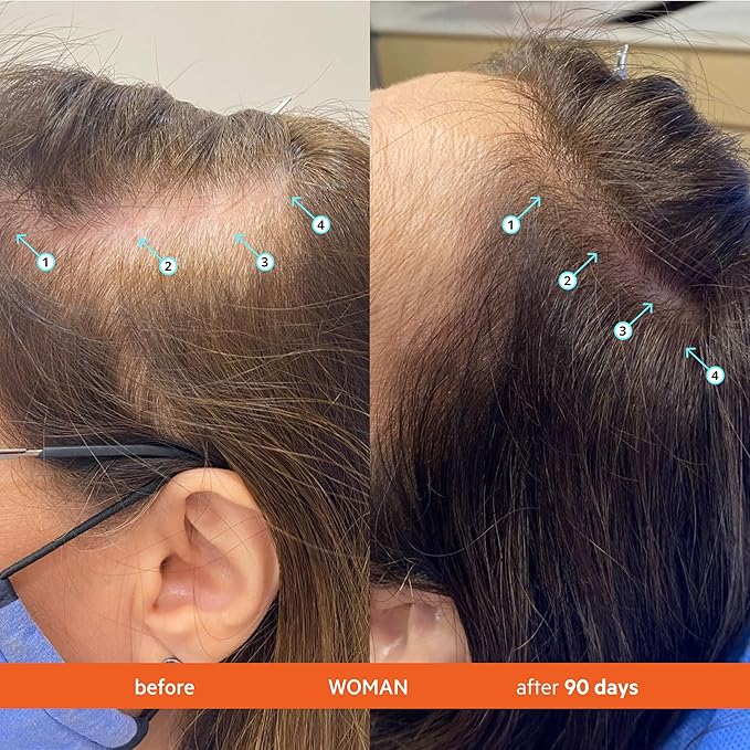 DS Labs Revita Conditioner, 205 mL – Scalp Refreshing Hydration for Fuller Looking, Weightless Hydration, Caffeine, Turmeric, Sulfate & Silicone Free, Color Safe, For Men & Women