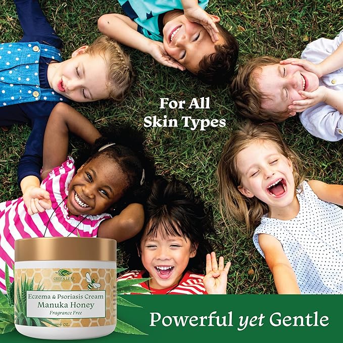 Manuka Honey Eczema Cream Moisturizing Lotion Fragrance Free For Psoriasis Relief - Itchy, Dry Skin Rash Ointment - Skin Soothing Moisturizer - Body & Face Cream - Kids & Adults 2oz