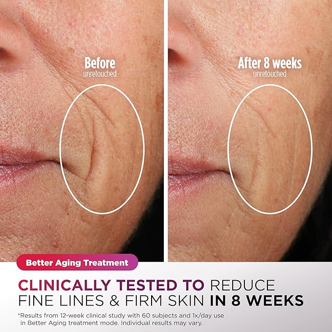 Shark CryoGlow LED Face Mask with Under-Eye Cooling, Anti-Ageing & Blemish Repair, Red & Blue LED, Infrared Light Therapy, USB-C, Remote Control, Storage Bag, Blue Frost, FW312